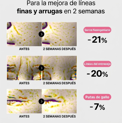 Parches para contorno de ojos